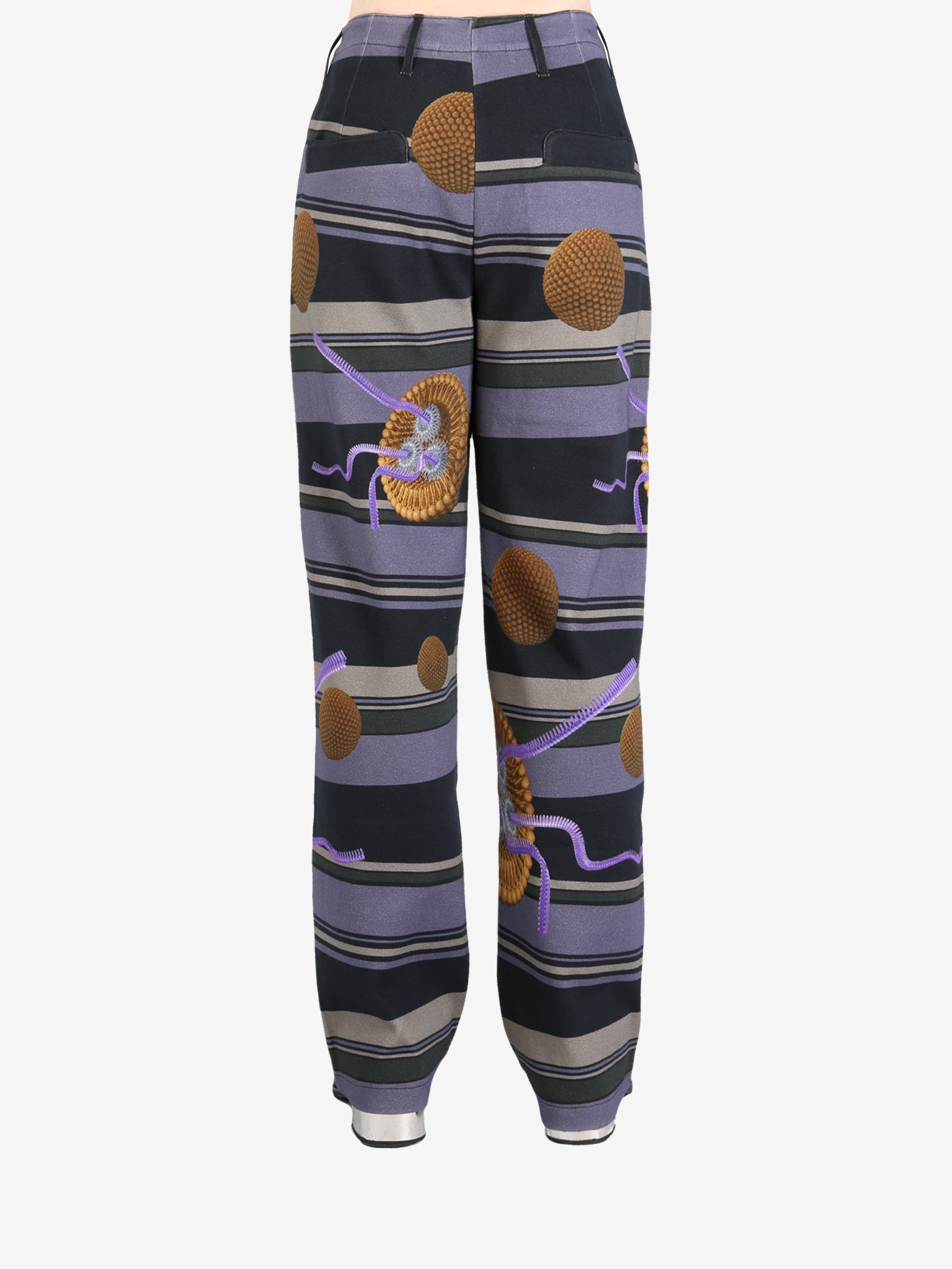 Black pants worn by a person, showing the pants' fit