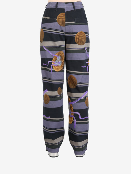 Black pants worn by a person, showing the pants' fit